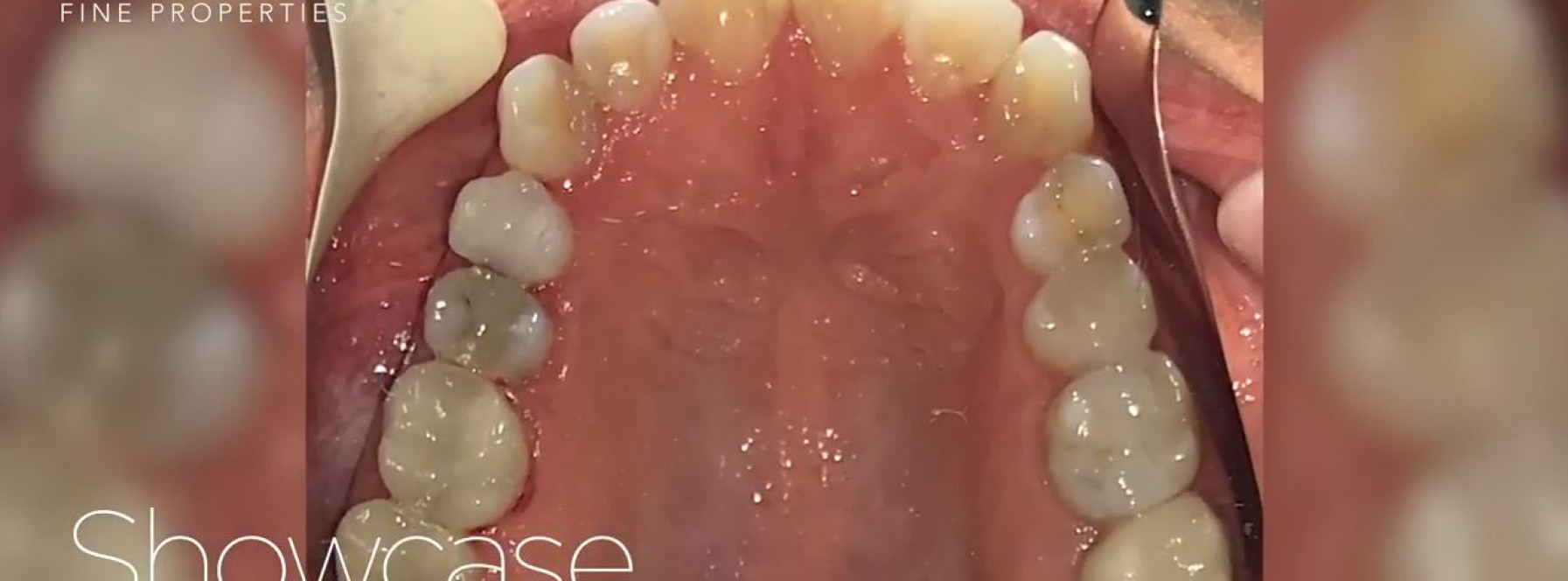 deFabrique Aesthetic Dentistry in Palm Beach Gardens, FL.